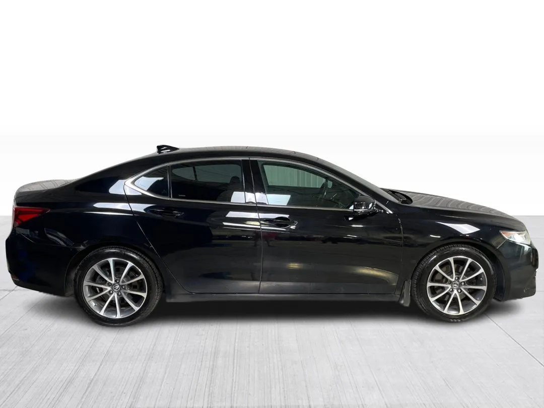 2015 Acura TLX — photo 2