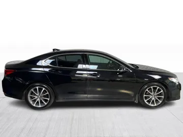 2015 Acura TLX - image 2