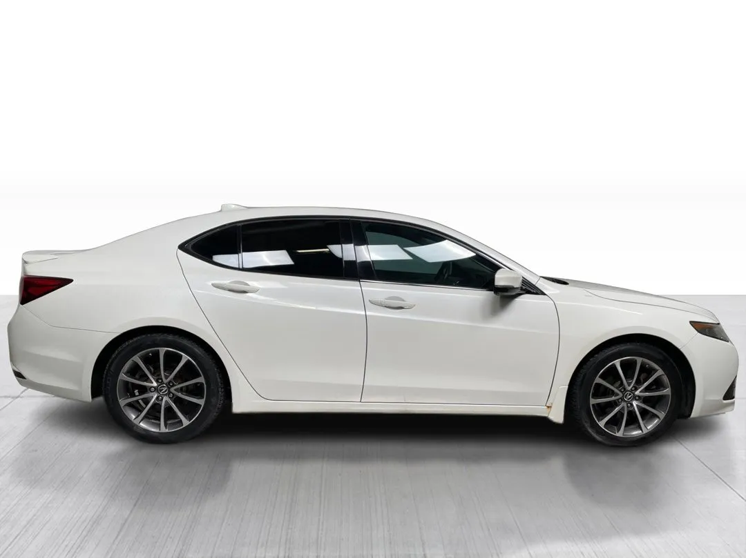 2017 Acura TLX — photo 2