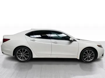 2017 Acura TLX - image 2