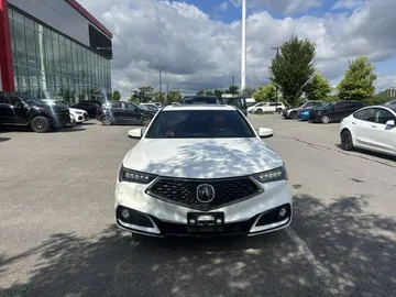 2018 Acura TLX - image 2