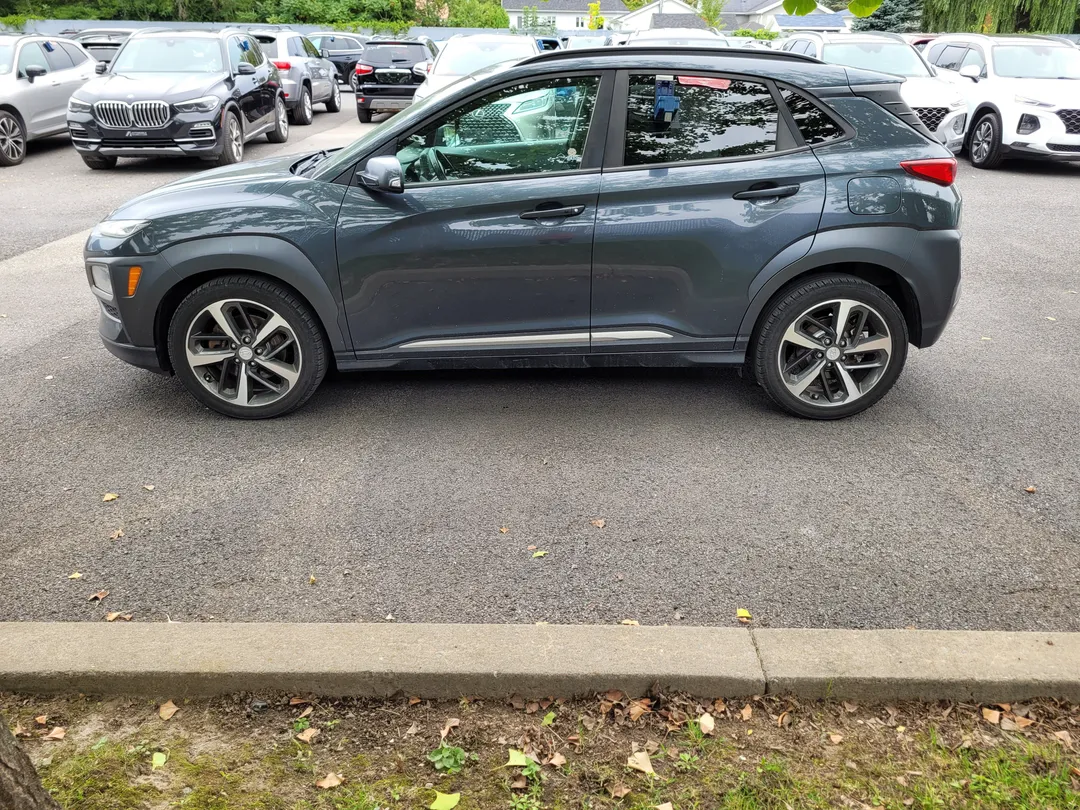 2018 Hyundai Kona for sale - photo 4